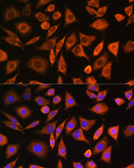 Immunofluorescence analysis of L929 cells using CNOT1 Polyclonal Antibody at dilution of 1:100. Blue: DAPI for nuclear staining.