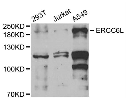 Western blot analysis of extracts of various cell lines using ERCC6L Polyclonal Antibody at 1:1000 dilution.