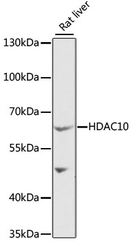 Western blot analysis of extracts of rat liver using HDAC10 Polyclonal Antibody at 1:1000 dilution.