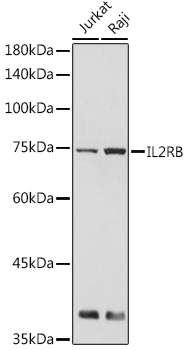 Western blot analysis of extracts of various cell lines using IL2RB Polyclonal Antibody at 1:500 dilution.