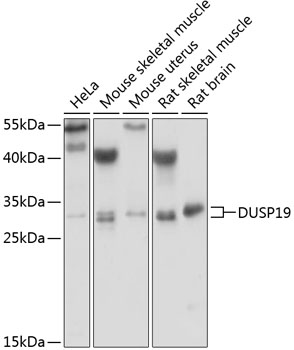 Western blot analysis of extracts of various cell lines using DUSP19 Polyclonal Antibody at 1:1000 dilution.