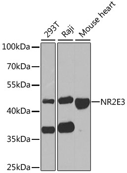 Western blot analysis of extracts of various cell lines using NR2E3 Polyclonal Antibody at 1:1000 dilution.