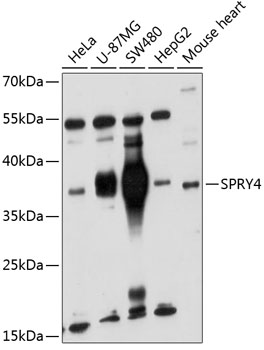 Western blot analysis of extracts of various cell lines using SPRY4 Polyclonal Antibody at 1:1000 dilution.