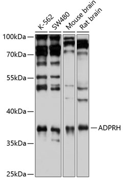 Western blot analysis of extracts of various cell lines using ADPRH Polyclonal Antibody at 1:1000 dilution.