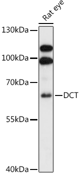 Western blot analysis of extracts of Rat eye using DCT Polyclonal Antibody at 1:1000 dilution.