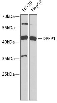 Western blot analysis of extracts of various cell lines using DPEP1 Polyclonal Antibody at 1:1000 dilution.