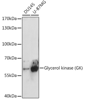 Western blot analysis of extracts of various cell lines using Glycerol kinase Polyclonal Antibody at 1:3000 dilution.