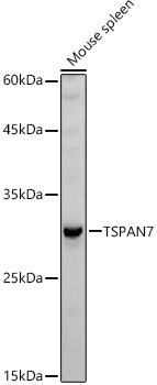 Western blot analysis of extracts of Mouse spleen using TSPAN7 Polyclonal Antibody at 1:1000 dilution.