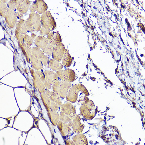 Immunohistochemistry of paraffin-embedded Human skeletal muscle using ACTC1 Polyclonal Antibody at dilution of 1:50 (40x lens).Perform high pressure antigen retrieval with 10 mM citrate buffer pH 6.0 before commencing with IHC staining protocol.