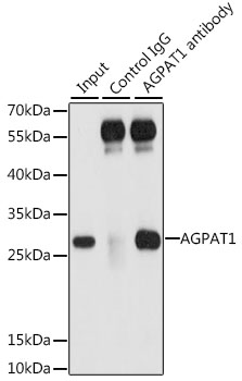 Immunoprecipitation analysis of 200ug extracts of 293T cells using 3 ug AGPAT1 Polyclonal Antibody.Western blot was performed from the immunoprecipitate using AGPAT1 Polyclonal Antibody at a dilution of 1:1000.