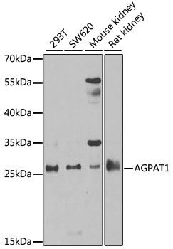 Western blot analysis of extracts of various cell lines using AGPAT1 Polyclonal Antibody at 1:1000 dilution.