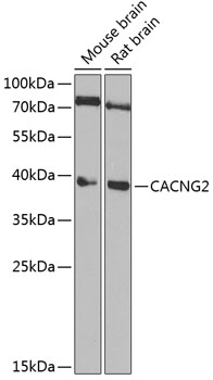 Western blot analysis of extracts of various cell lines using CACNG2 Polyclonal Antibody at 1:1000 dilution.