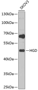 Western blot analysis of extracts of SKOV3 cells using HGD Polyclonal Antibody at 1:1000 dilution.