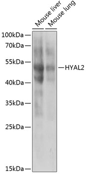 Western blot analysis of extracts of various cell lines using HYAL2 Polyclonal Antibody at 1:1000 dilution.