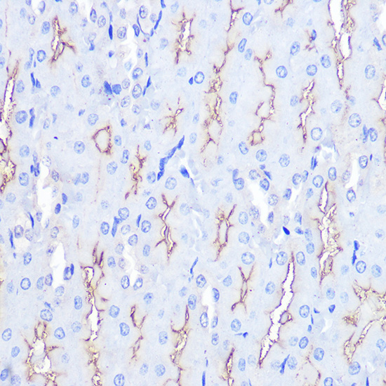 Immunohistochemistry of paraffin-embedded rat kidney using MAPKAP1 Polyclonal Antibody at dilution of 1:100 (40x lens).Perform microwave antigen retrieval with 10 mM PBS buffer pH 7.2 before commencing with IHC staining protocol.