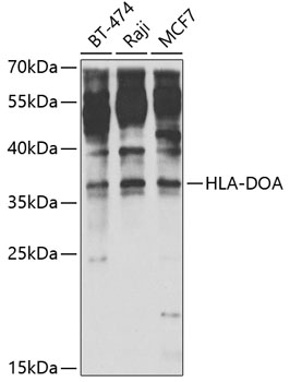 Western blot analysis of extracts of various cell lines using HLA-DOA Polyclonal Antibody at 1:1000 dilution.