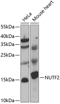 Western blot analysis of extracts of various cell lines using NUTF2 Polyclonal Antibody at 1:1000 dilution.