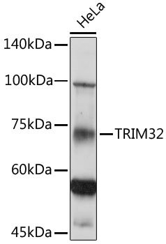 Western blot analysis of extracts of HeLa cells using TRIM32 Polyclonal Antibody at 1:500 dilution.