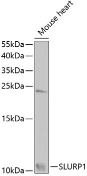 Western blot analysis of extracts of mouse heart using SLURP1 Polyclonal Antibody at 1:1000 dilution.