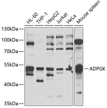 Western blot analysis of extracts of various cell lines using ADPGK Polyclonal Antibody at 1:1000 dilution.