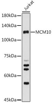 Western blot analysis of extracts of Jurkat cells using MCM10 Polyclonal Antibody at 1:500 dilution.