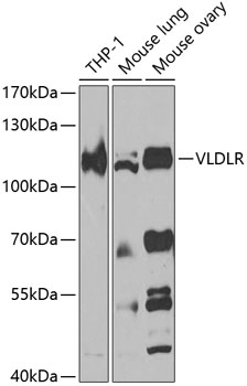 Western blot analysis of extracts of various cell lines using VLDLR Polyclonal Antibody at 1:1000 dilution.