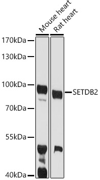 Western blot analysis of extracts of various cell lines using SETDB2 Polyclonal Antibody at 1:1000 dilution.