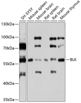 Western blot analysis of extracts of various cell lines using BLK Polyclonal Antibody at 1:1000 dilution.