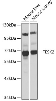 Western blot analysis of extracts of various cell lines using TESK2 Polyclonal Antibody at 1:1000 dilution.