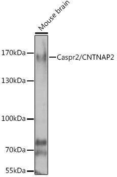 Western blot analysis of extracts of mouse brain using Caspr2/Caspr2/CNTNAP2 Polyclonal Antibody at 1:1000 dilution.