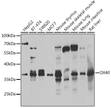 Western blot analysis of extracts of various cell lines using CD134/OX40 Polyclonal Antibody at 1:1000 dilution.