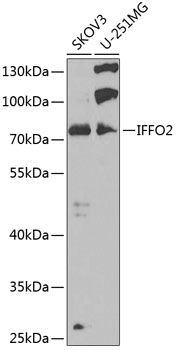 Western blot analysis of extracts of various cell lines using IFFO2 Polyclonal Antibody at 1:1000 dilution.