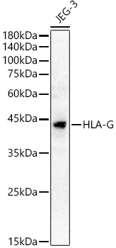 Western blot analysis of JEG-3 using HLA-G Polyclonal Antibody at 1:1000 dilution.