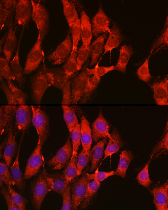 Immunofluorescence analysis of C6 cells using NRAS Polyclonal Antibody at dilution of 1:100 (40x lens). Blue: DAPI for nuclear staining.