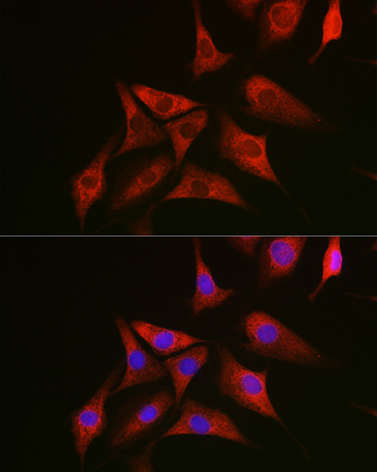 Immunofluorescence analysis of NIH/3T3 cells using NRAS Polyclonal Antibody at dilution of 1:100 (40x lens). Blue: DAPI for nuclear staining.