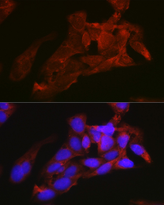 Immunofluorescence analysis of U2OS cells using NRAS Polyclonal Antibody at dilution of 1:100 (40x lens). Blue: DAPI for nuclear staining.