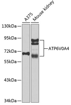 Western blot analysis of extracts of various cell lines using ATP6V0A4 Polyclonal Antibody at 1:1000 dilution.