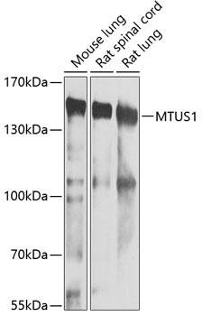 Western blot analysis of extracts of various cell lines using MTUS1 Polyclonal Antibody at 1:1000 dilution.