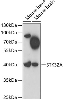 Western blot analysis of extracts of various cell lines using STK32A Polyclonal Antibody at 1:1000 dilution.