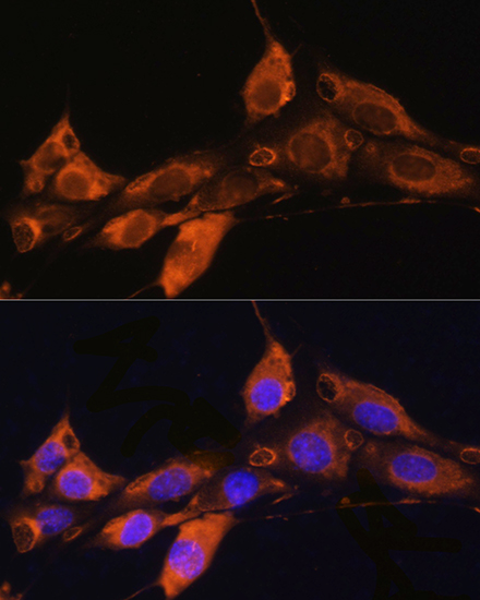 Immunofluorescence analysis of NIH/3T3 cells using ARF4 Polyclonal Antibody at dilution of 1:100. Blue: DAPI for nuclear staining.