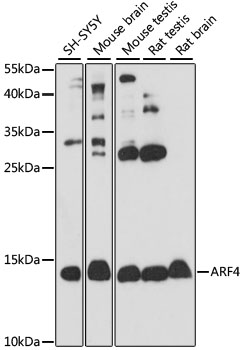 Western blot analysis of extracts of various cell lines using ARF4 Polyclonal Antibody at 1:1000 dilution.