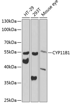 Western blot analysis of extracts of various cell lines using CYP11B1 Polyclonal Antibody at 1:1000 dilution.