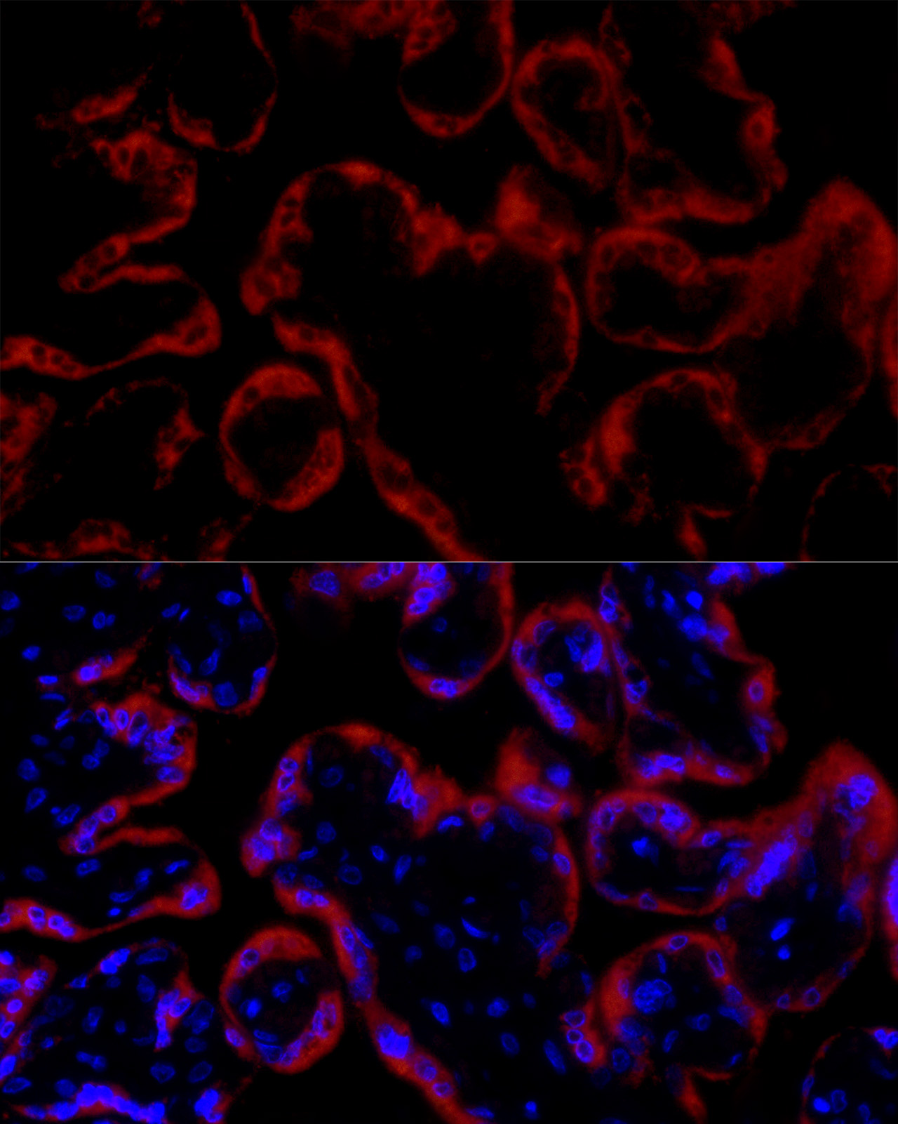 Immunofluorescence analysis of human placenta cells using GH1 Polyclonal Antibody at dilution of 1:20 (40x lens). Blue: DAPI for nuclear staining.