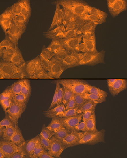 Immunofluorescence analysis of U2OS cells using PFKL Polyclonal Antibody at dilution of 1:100. Blue: DAPI for nuclear staining.