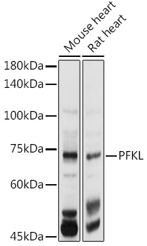 Western blot analysis of extracts of various cell lines using PFKL Polyclonal Antibody at 1:1000 dilution.