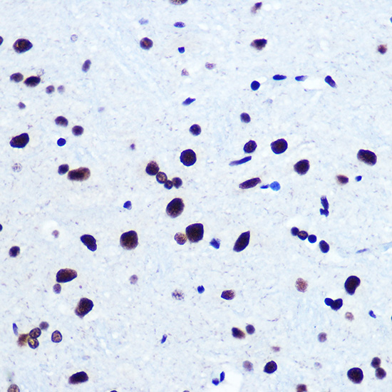 Immunohistochemistry of paraffin-embedded rat brain using SRF Polyclonal Antibody at dilution of 1:100 (40x lens).Perform microwave antigen retrieval with 10 mM PBS buffer pH 7.2 before commencing with IHC staining protocol.