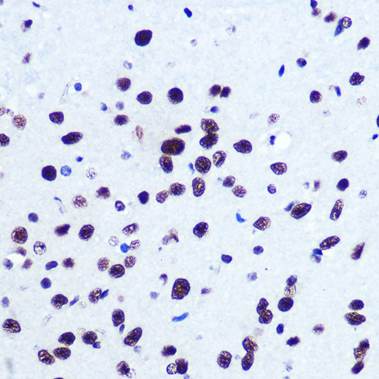 Immunohistochemistry of paraffin-embedded human esophageal using SRF Polyclonal Antibody at dilution of 1:100 (40x lens).Perform microwave antigen retrieval with 10 mM PBS buffer pH 7.2 before commencing with IHC staining protocol.