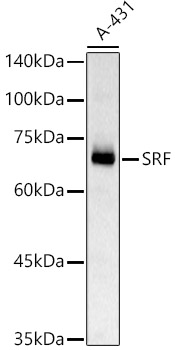 Western blot analysis of A-431 using SRF Polyclonal Antibody at 1:1000 dilution.