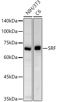 Western blot analysis of various lysates using SRF Polyclonal Antibody at 1:1000 dilution.
