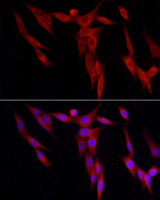 Immunofluorescence analysis of NIH/3T3 cells using WDR6 Polyclonal Antibody at dilution of 1:200 (40x lens). Blue: DAPI for nuclear staining.